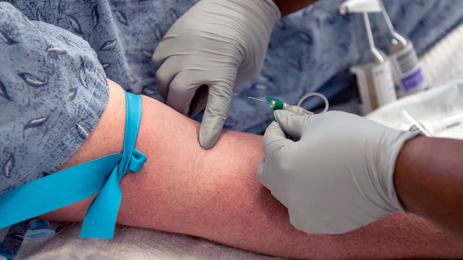 Personal de salud, con guantes, coloca un catéter intravenoso en el brazo de un paciente con torniquete azul, a color
